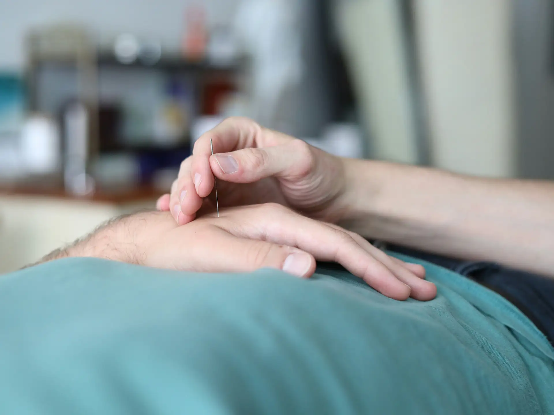 acupuncture-1